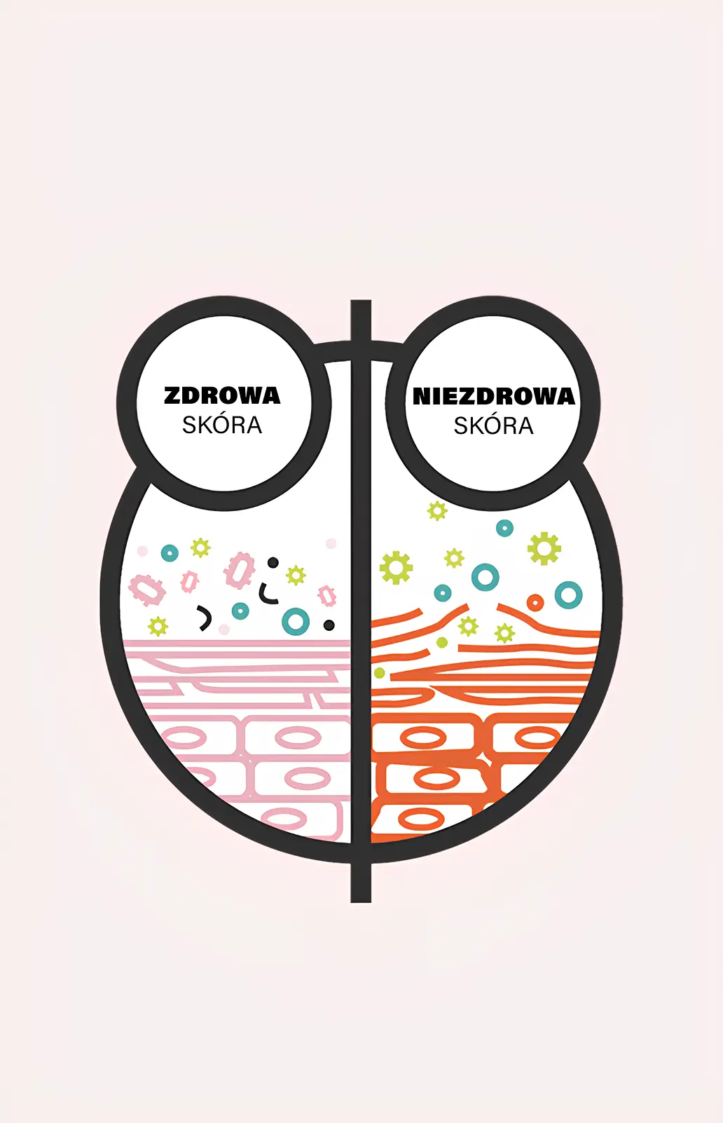 Ilustracja pokazująca r&oacute;żnicę między zdrową a niezdrową sk&oacute;rą.