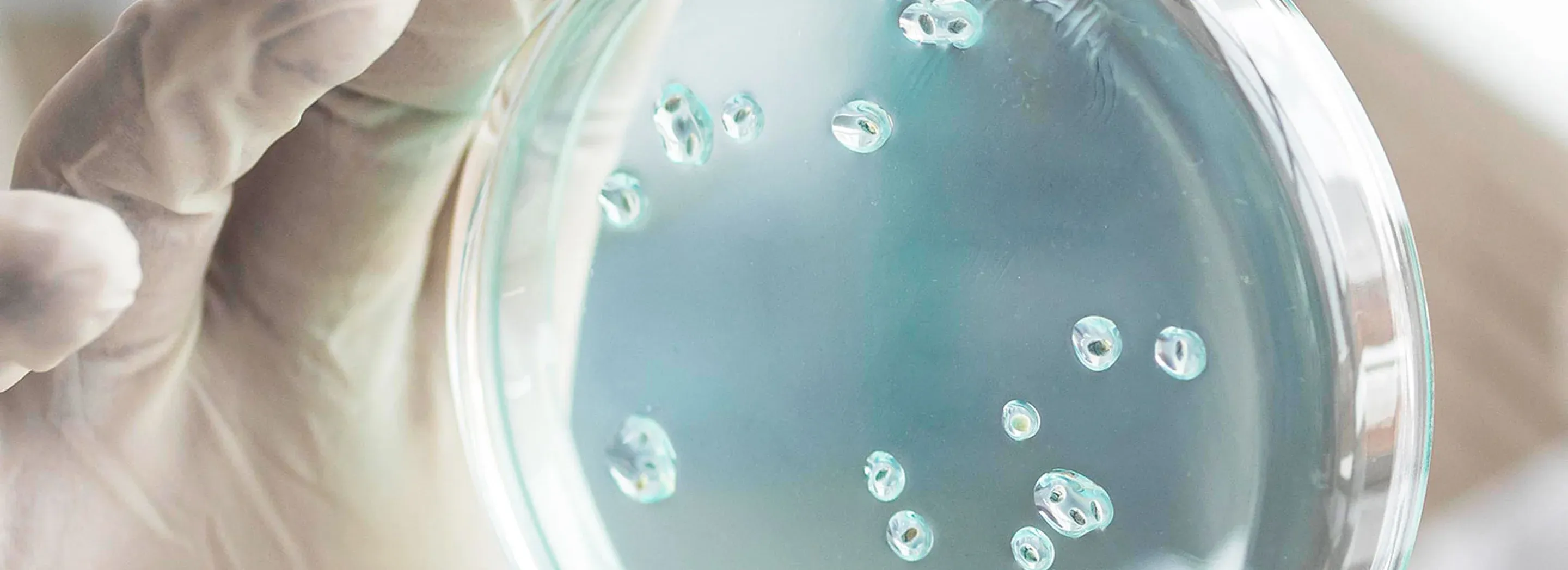 Szalka Petriego z hodowlą bakterii &ndash; badania nad skutecznością probiotyk&oacute;w YUN Probiotherapy